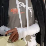 Βόλος: Δύο χρόνια φυλακή στον 31χρονο που έσπασε το χέρι οδηγού ταξί με σκουπόξυλο