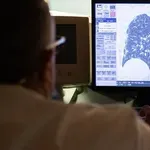 Ο καρκίνος του πνεύμονα μπορεί να εμφανιστεί και σε μη καπνιστές – Τι δείχνει η περίπτωση του Πάπα