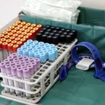 Έλλειψη σιδήρου: Η ASH ανεβάζει τα όρια φερριτίνης – Ποιες είναι οι νέες τιμές