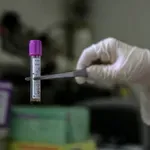 Ρωσία: Κανένας κίνδυνος επιδημίας για την πανώλη – Ενήμερος ο ΠΟΥ για την κατάσταση στη Σιβηρία