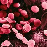 Pronađena nova krvna grupa posle 50 godina misterije: Lekari izvadili krv trudnice i gledali rezultate u čudu