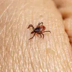 Kako pravilno odstraniti klopa in kaj narediti, če ostaneta glava ali nogica? (VIDEO)