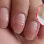 Vaše nehty prozradí víc, než myslíte: Co znamenají podélné rýhy