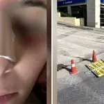 Ηράκλειο: Ταμπέλα εκτοξεύτηκε από τον αέρα και χτύπησε 29χρονη στο κεφάλι!