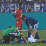 VIDEO / Džeko krvavog lica ostao ležati na travnjaku, morao je ranije izaći iz igre