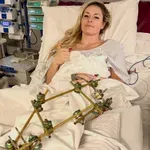 Hirurg o Von: Prelom nije saniran, prioritet spašavanje noge