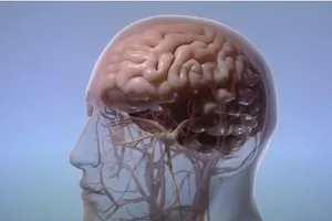 Magnetna rezonanca pokazala šta migrena radi mozgu