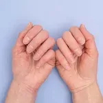 Promjene na noktima mogu ukazivati na ozbiljne zdravstvene probleme