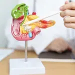 Ne ignorišite ove znakove: Ljekari upozoravaju na skrivene simptome raka pankreasa