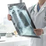 Rusija počela da koristi novi lijek za liječenje kancera