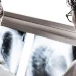 Jednostavan test koji može da otkrije opaku bolest