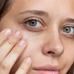 Ove promjene na vašem tijelu ukazuju na nedostatak vitamina