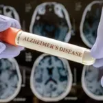 Izvor kome smo svi izloženi povećava rizik od Alchajmerove bolesti