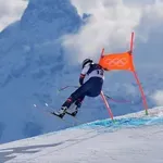 Von otkrila: Doktor Tom Heket spasio mi je nogu od amputacije