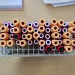 Medicinski otpad pronađen bačen pored puta kod Suvog Dola