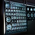 DW: Zašto su deveta, 32, 66. i 83. bitne godine za naš mozak?