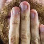 10 съвета как да спрем досадното хълцане