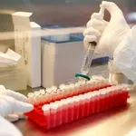 ΕΟΔΥ: 104 νέες εισαγωγές Covid 19 και 7 νέοι θάνατοι την τελευταία εβδομάδα