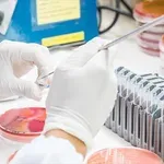 Politico: Κόλαφος για το brain drain – “Η Ελλάδα σαμποτάρει τα δικά της σχέδια”
