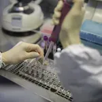 ΠΟΥ- Χανταϊός: Ο κίνδυνος στην φάση αυτή παραμένει χαμηλός για την δημόσια υγεία παγκοσμίως