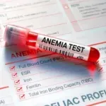 Koji su znaci i simptomi anemije uzrokovane nedostatkom gvožđa