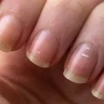 Šta znače promjene na noktima: Evo kada trebate posjetiti ljekara