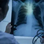 Šokantni rezultati studije: Vejping vjerovatno izaziva rak pluća i usne duplje