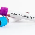 U Crnoj Gori 44 slučaja hantavirusa u posljednjih deset godina
