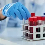 Krvni test otkriva znakove Alchajmerove bolesti "decenijama prije simptoma"