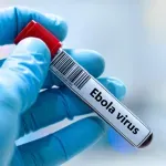 Italija: Pokrenuti protokoli zbog sumnje na slučaj ebole