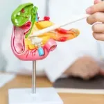 Kraj dugog liječenja? Nova terapija pankreatitisa skraćuje boravak u bolnici