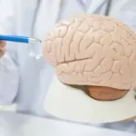 Vještačka inteligencija otkriva oštećenja mozga koja nisu bila vidljiva