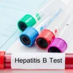 Svjetski dan borbe protiv hepatitisa: IJZCG organizuje besplatno testiranje