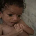 UNICEF: Sve više gladne djece u Jemenu