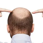 Predsednik Južne Koreje predložio: Razmotriti pokriće gubitka kose javnim osiguranjem