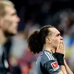 Ajntraht posle blamaže u meču sa Lajpcigom smenio doktora zbog bizarne situacije