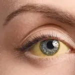 Visok holesterol često prolazi neprimećeno – ovo su 3 suptilna znaka upozorenja