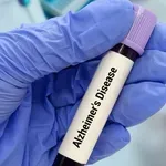 Novi test iz krvi mogao bi da otkrije rizik od Alchajmera mnogo pre pojave prvih simptoma