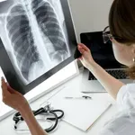 Znanstveniki odkrili razlog, ki močno poveča tveganje za pljučnega raka: najbolj ogroženi so nekadilci