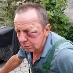 Nov napad Romov: člani družine Strojan naj bi brutalno pretepli 72-letnika