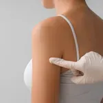 Ste na koži opazili takšna znamenja? Potem morate nujno obiskati zdravnika