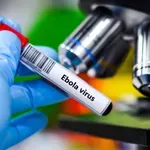 Svet v pripravljenosti: smrtonosni virus terja življenja, strokovnjaki opozarjajo na najhujšo epidemijo do zdaj