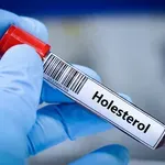 Tihi simptomi povišanega holesterola: ljudje, ki jih imajo, se pogosto ne zavedajo, kaj jim sporoča telo