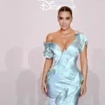 Kim Kardašijan kaže da je dobila aneurizmu od stresa