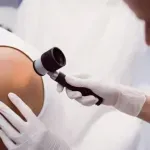 Udruženje obolelih od melanoma: Srbija na prvom mestu po smrtnosti od raka kože