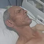 Srbin iz Drena nakon što ga je kosovska policija pretukla: „Upali su u u kuću i maltretirali mi ženu i sina“
