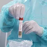 Φυματίωση: Παραμένει σπάνια η νόσος στην Κρήτη – Προβληματισμός για τις δομές που ευνοούν τη μετάδοση