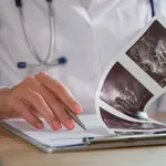 Kako in kdaj ste upravičeni do NIPT na napotnico?