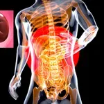 Epidemija hronične bolesti bubrega u Srbiji: Pogođeno 700.000 građana