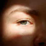 Как да се справите с мелазмата?